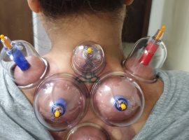 cupping 2-min